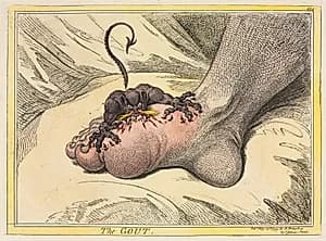Portrait of James Gillray (British, 1757–1815)