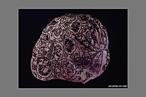 Coif by Unknown Artist
