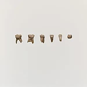 Tooth, 5 by Unknown Artist