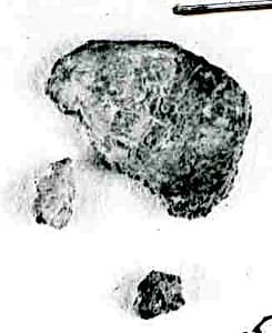 Coin by Unknown Artist