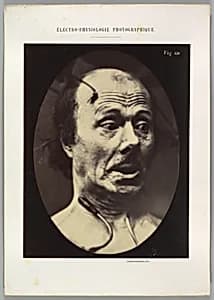 Figure 60: Fright by Guillaume-Benjamin-Amand Duchenne de Boulogne|Adrien Tournachon
