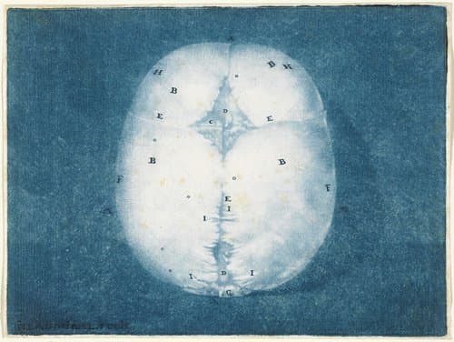 Anatomische studie van de schedel van een onvoldragen kindje by Jan l'Admiral