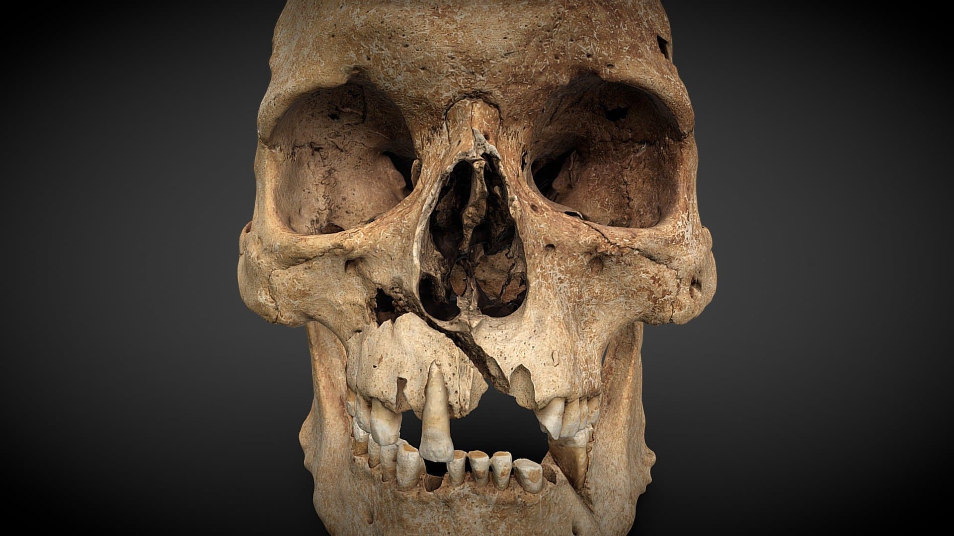Cranium with injuries - 260727