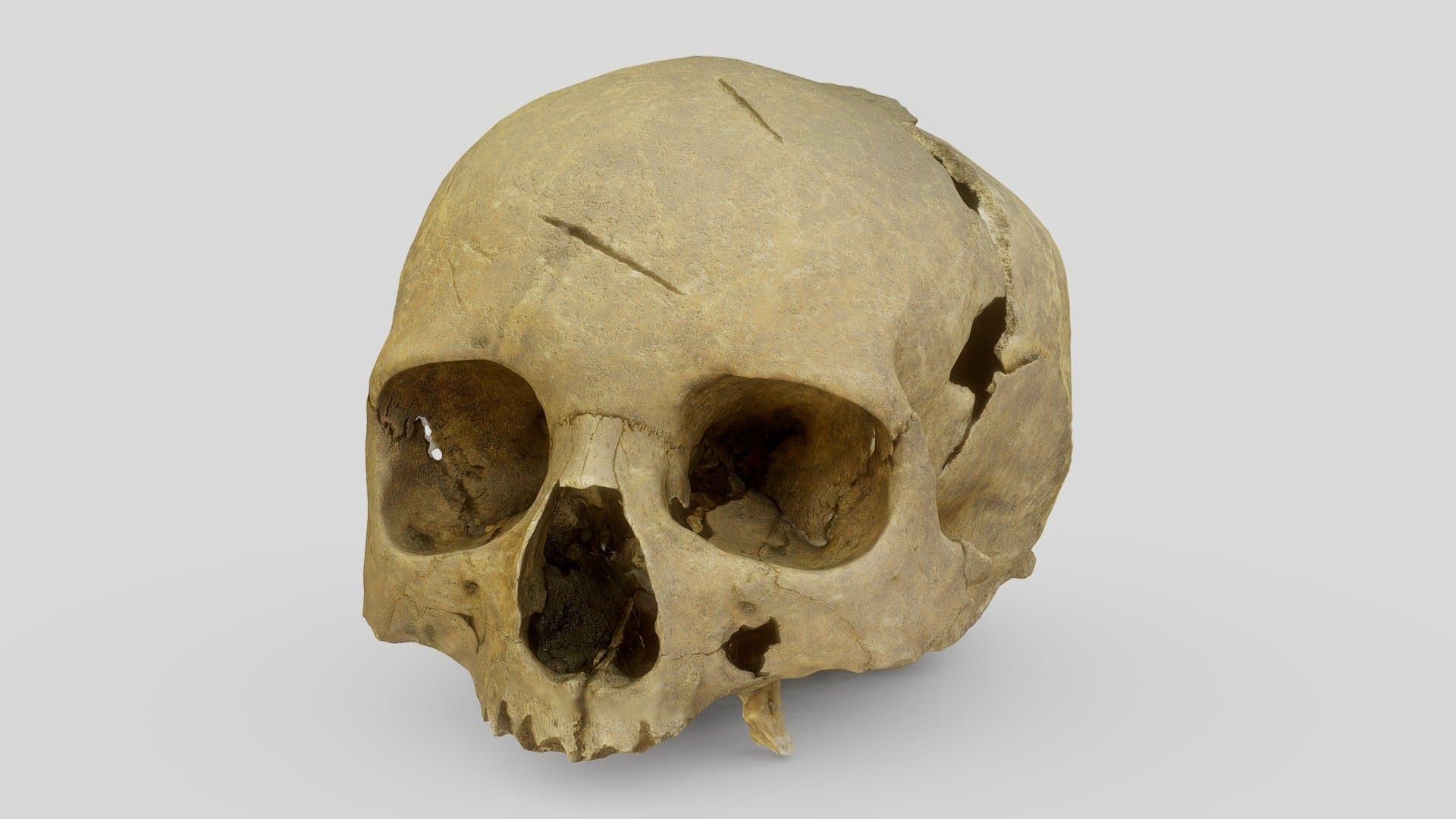 Female skull, injured by a medieval sword (1297)