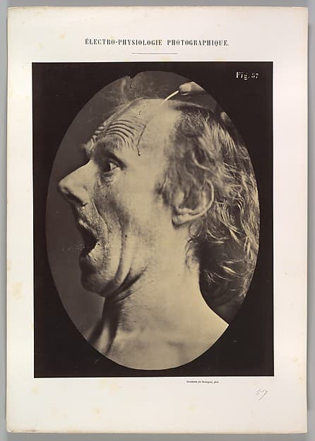 Figure 57: Astonishment, stupefaction, amazement